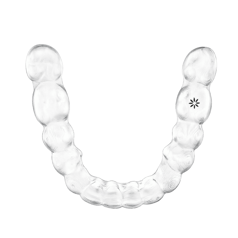 Invisalign beugel bovenaanzicht